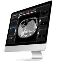 Imágenes médicas procesadas en MATLAB en la pantalla de la computadora