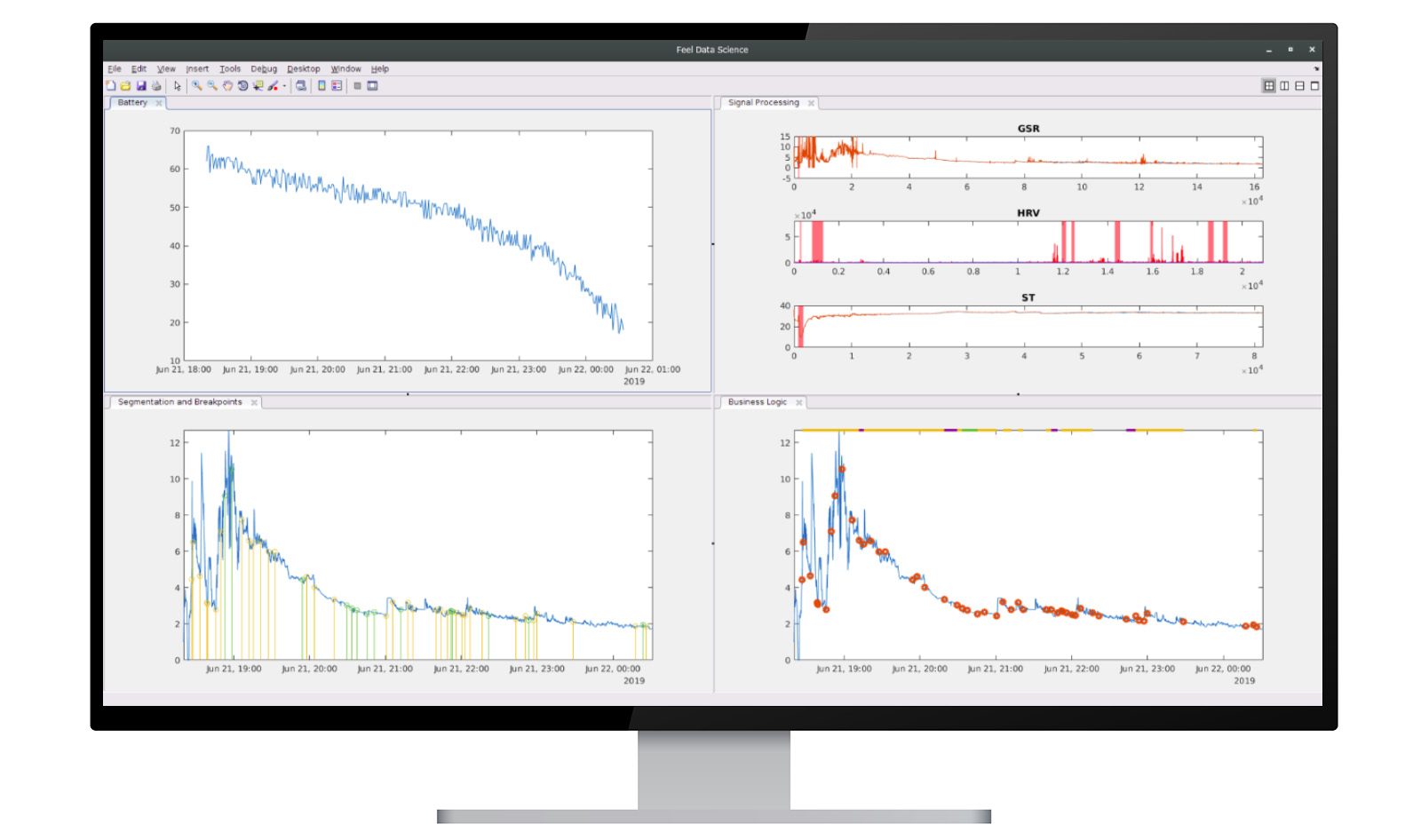 Los algoritmos de aprendizaje automático y procesamiento de señales utilizan datos fisiológicos capturados por el sensor 